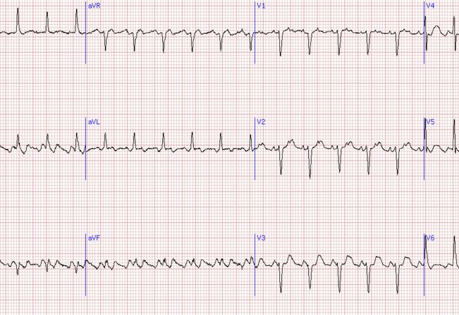 【kycom】预测:2016年牛奶价格不会超过4元/公斤(图2) 【kycom】预测:2016年牛奶价格不会超过4元/公斤(图2)